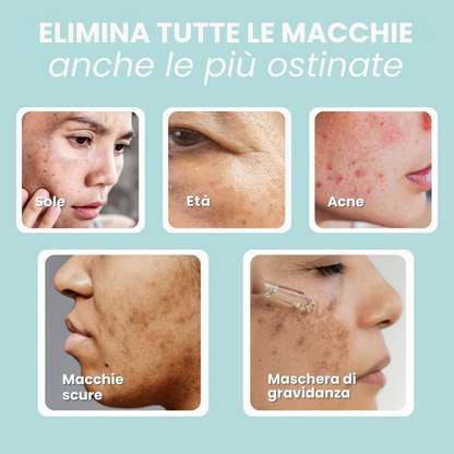 Siero Anti-Macchie – Pelle uniforme e luminosa